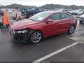 2017 Hyundai Elantra — photo 2 of 17 | VIN KMHD84LF3HU339093