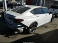 2025 Acura TLX — photo 4 of 22 | VIN 19UUB6F58SA002157