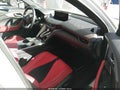2025 Acura TLX — photo 5 of 22 | VIN 19UUB6F58SA002157