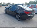 2016 Acura TLX — photo 3 of 20 | VIN 19UUB2F58GA009576