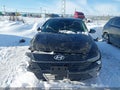 Photo 12 of 16 — 2024 Hyundai Elantra