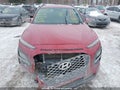 Photo 11 of 20 — 2018 Hyundai Kona