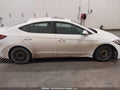 Photo 13 of 17 — 2017 Hyundai Elantra