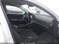 2025 Hyundai Elantra — photo 5 of 17 | VIN KMHLM4DG7SU007406