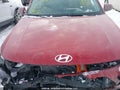 Photo 10 of 22 — 2025 Hyundai Kona