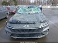 Photo 12 of 21 — 2025 Hyundai Elantra