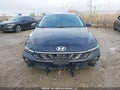 Photo 12 of 19 — 2024 Hyundai Elantra