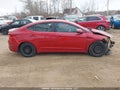 Photo 13 of 17 — 2018 Hyundai Elantra