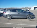 Photo 13 of 21 — 2020 Hyundai Elantra