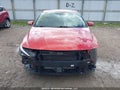 Photo 13 of 18 — 2022 Hyundai Elantra