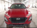 Photo 12 of 21 — 2018 Hyundai Kona