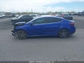 Photo 15 of 20 — 2020 Hyundai Elantra