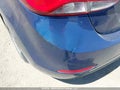 Photo 20 of 20 — 2015 Hyundai Elantra