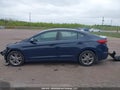 Photo 14 of 21 — 2017 Hyundai Elantra
