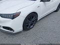Photo 6 of 17 — 2018 Acura TLX