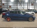 Photo 14 of 20 — 2017 Hyundai Elantra
