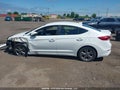 Photo 15 of 21 — 2017 Hyundai Elantra