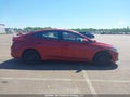 Photo 13 of 21 — 2018 Hyundai Elantra