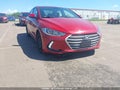 Photo 6 of 21 — 2018 Hyundai Elantra