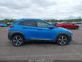 Photo 13 of 20 — 2019 Hyundai Kona