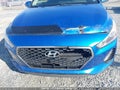 Photo 6 of 18 — 2018 Hyundai Elantra