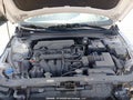 2024 Hyundai Elantra — photo 10 of 20 | VIN KMHLM4DG3RU796115