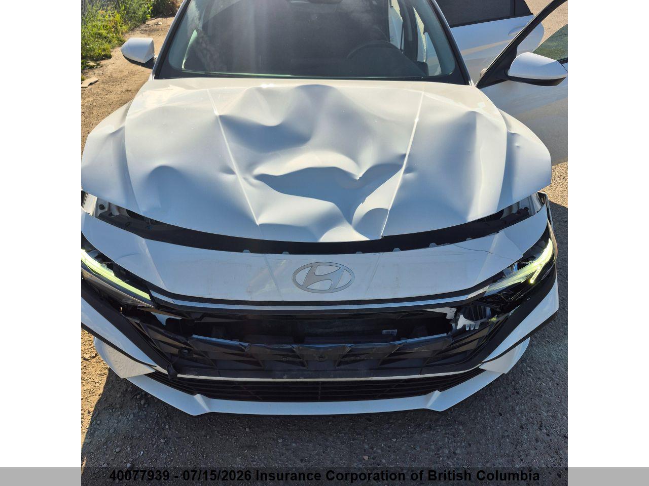 2025 HYUNDAI ELANTRA SEL SPORT thumbnail 6