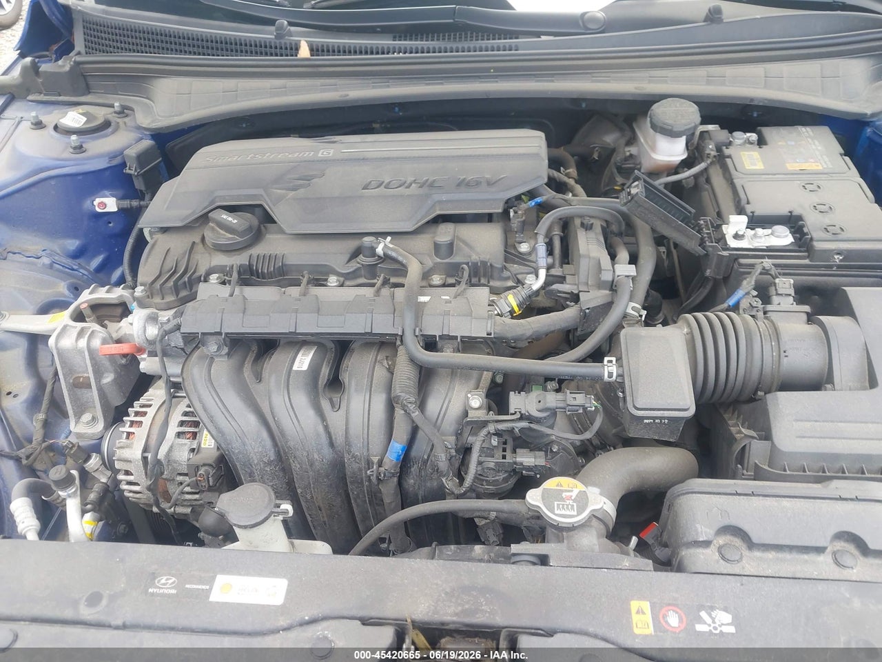 2021 HYUNDAI ELANTRA SE thumbnail 11