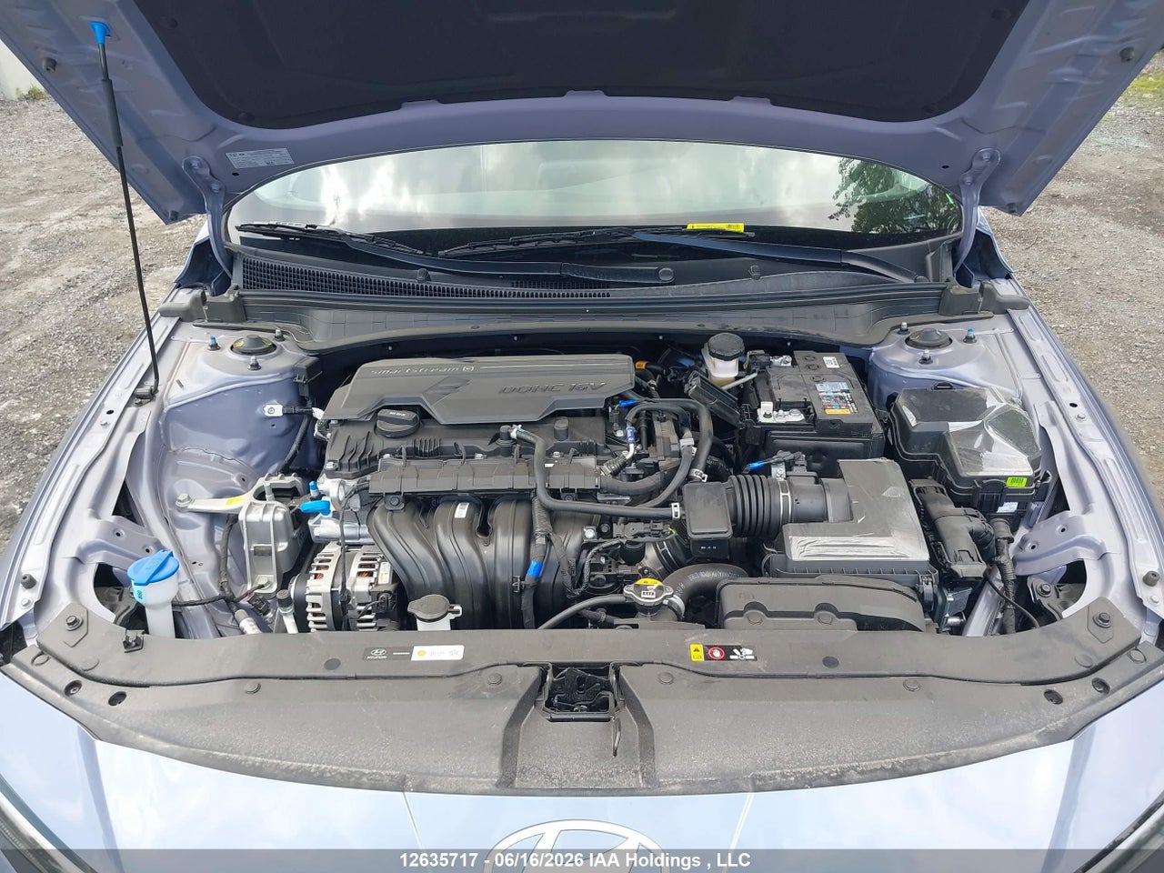 2026 HYUNDAI ELANTRA SEL SPORT thumbnail 11