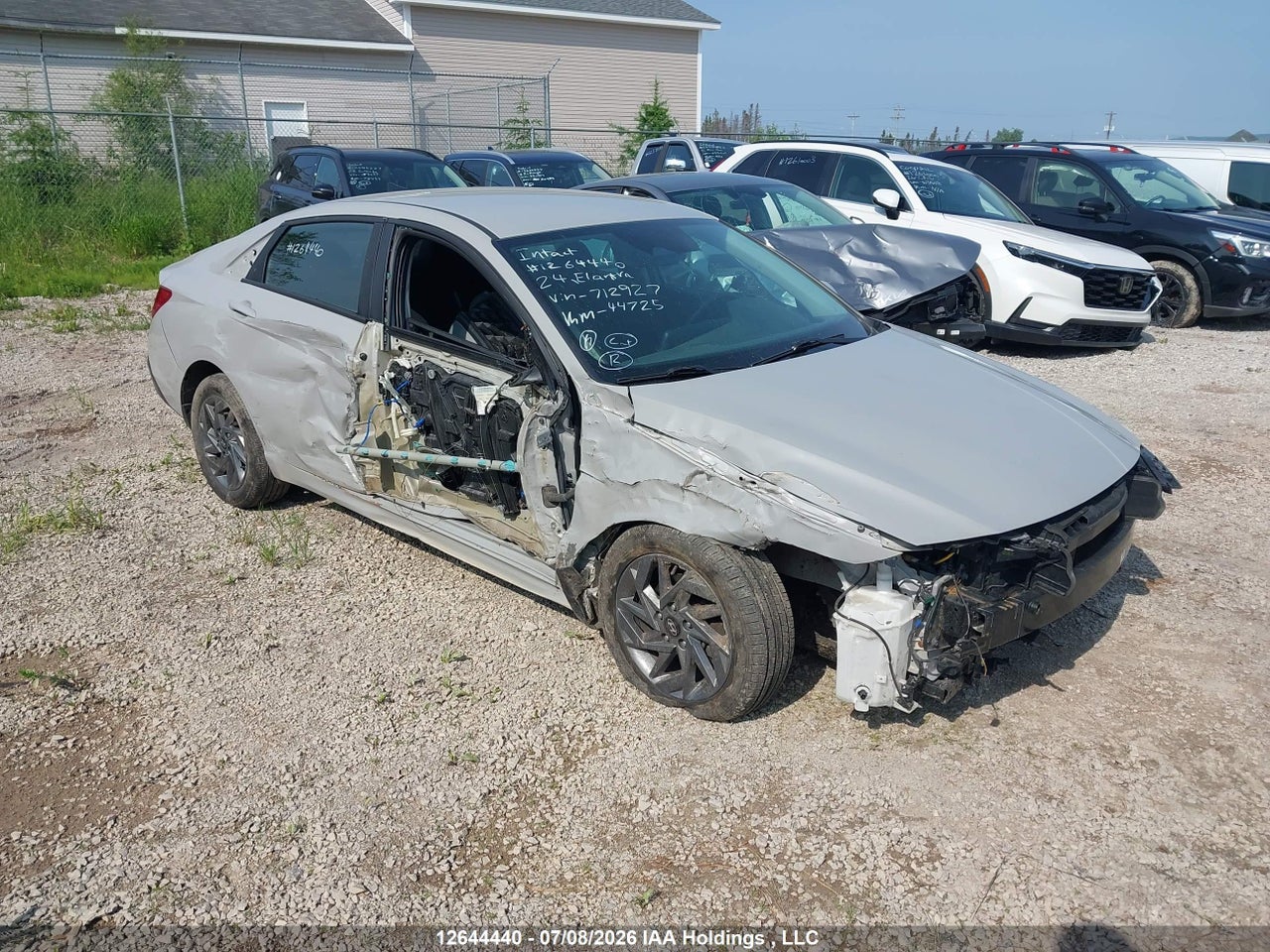 2024 HYUNDAI ELANTRA SEL thumbnail 2