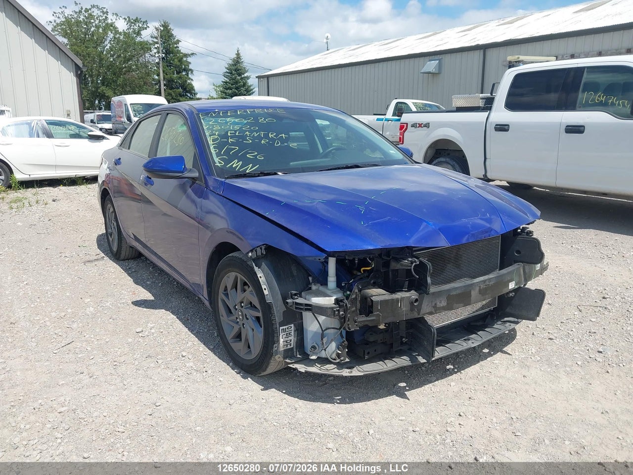 2024 HYUNDAI ELANTRA SEL thumbnail 2