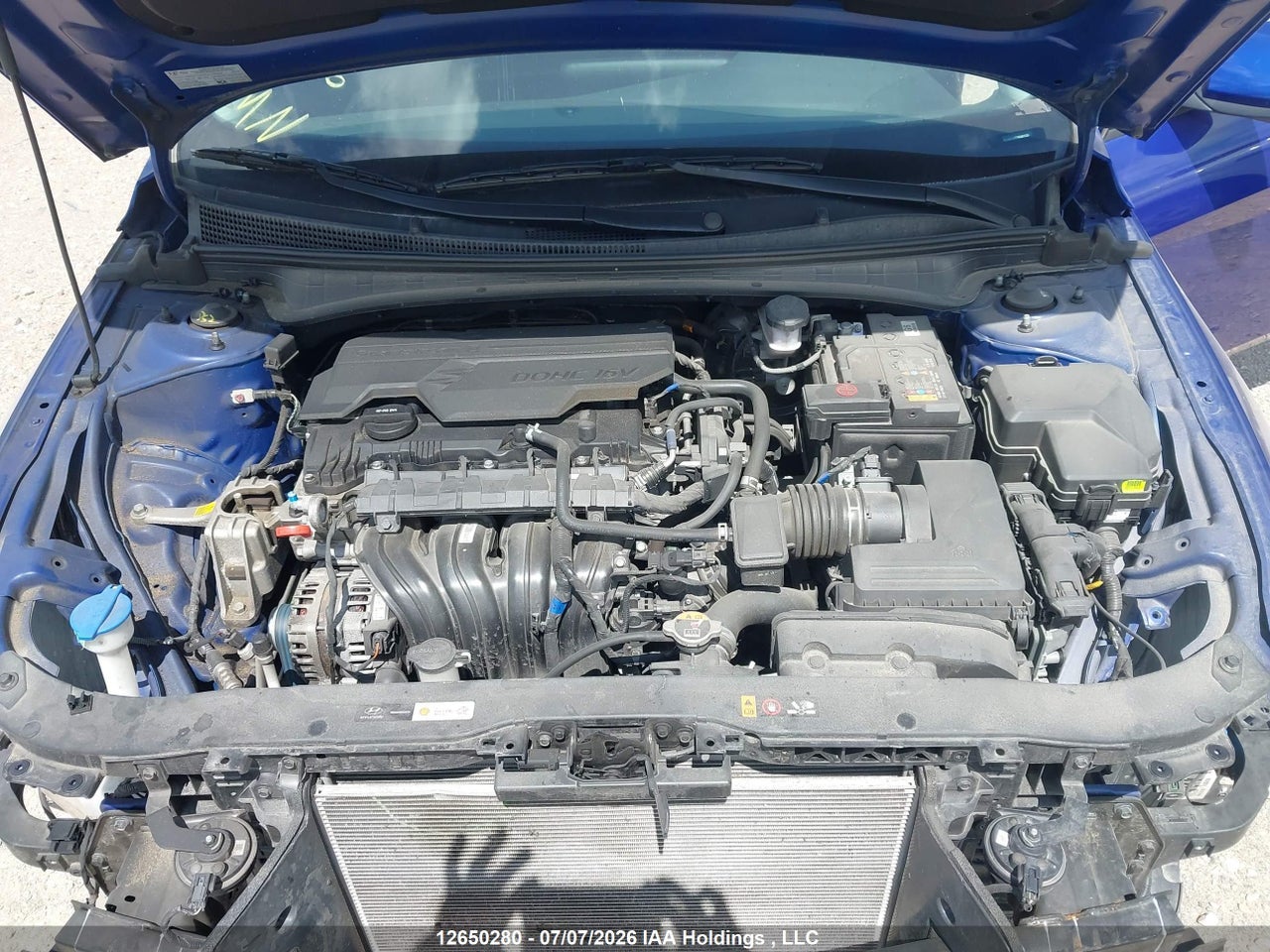 2024 HYUNDAI ELANTRA SEL thumbnail 11