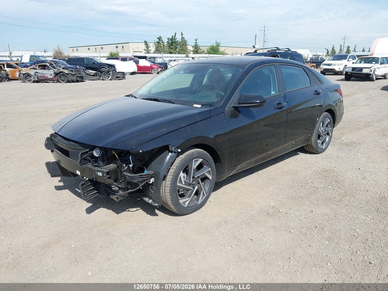 2026 HYUNDAI ELANTRA SEL SPORT thumbnail 3