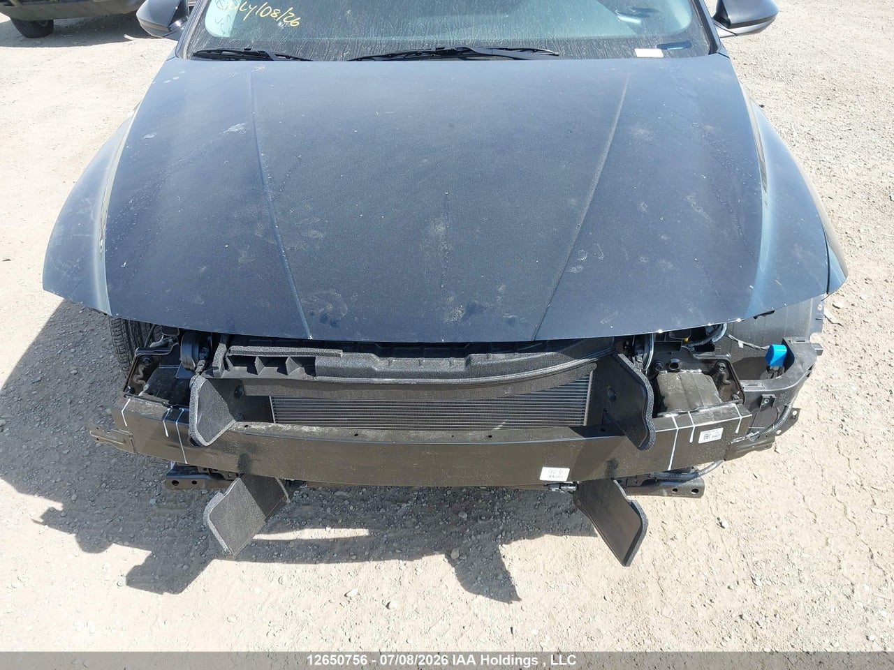 2026 HYUNDAI ELANTRA SEL SPORT thumbnail 7
