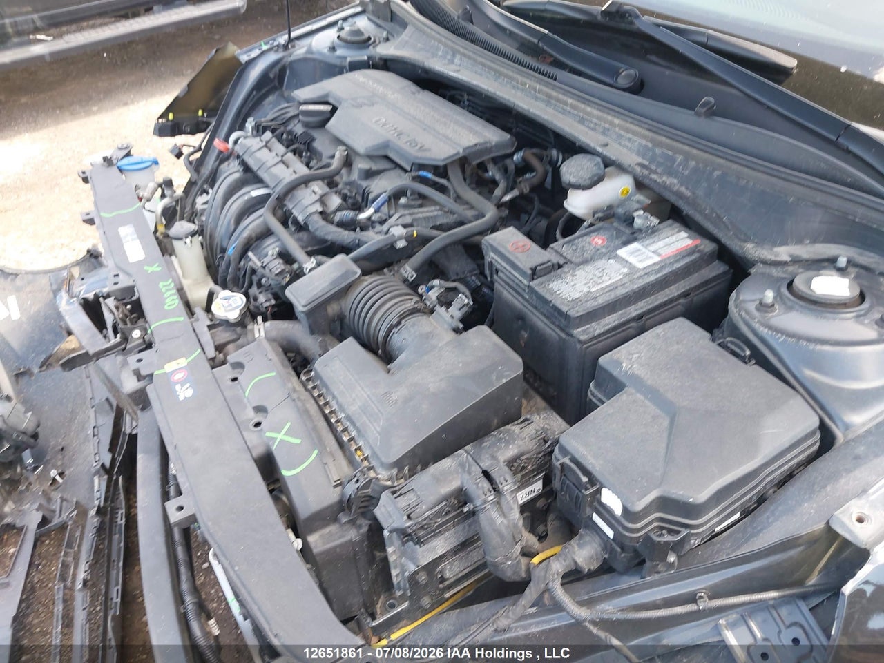 2022 HYUNDAI ELANTRA ULTIMATE IVT WITH TECH PACKAGE thumbnail 11