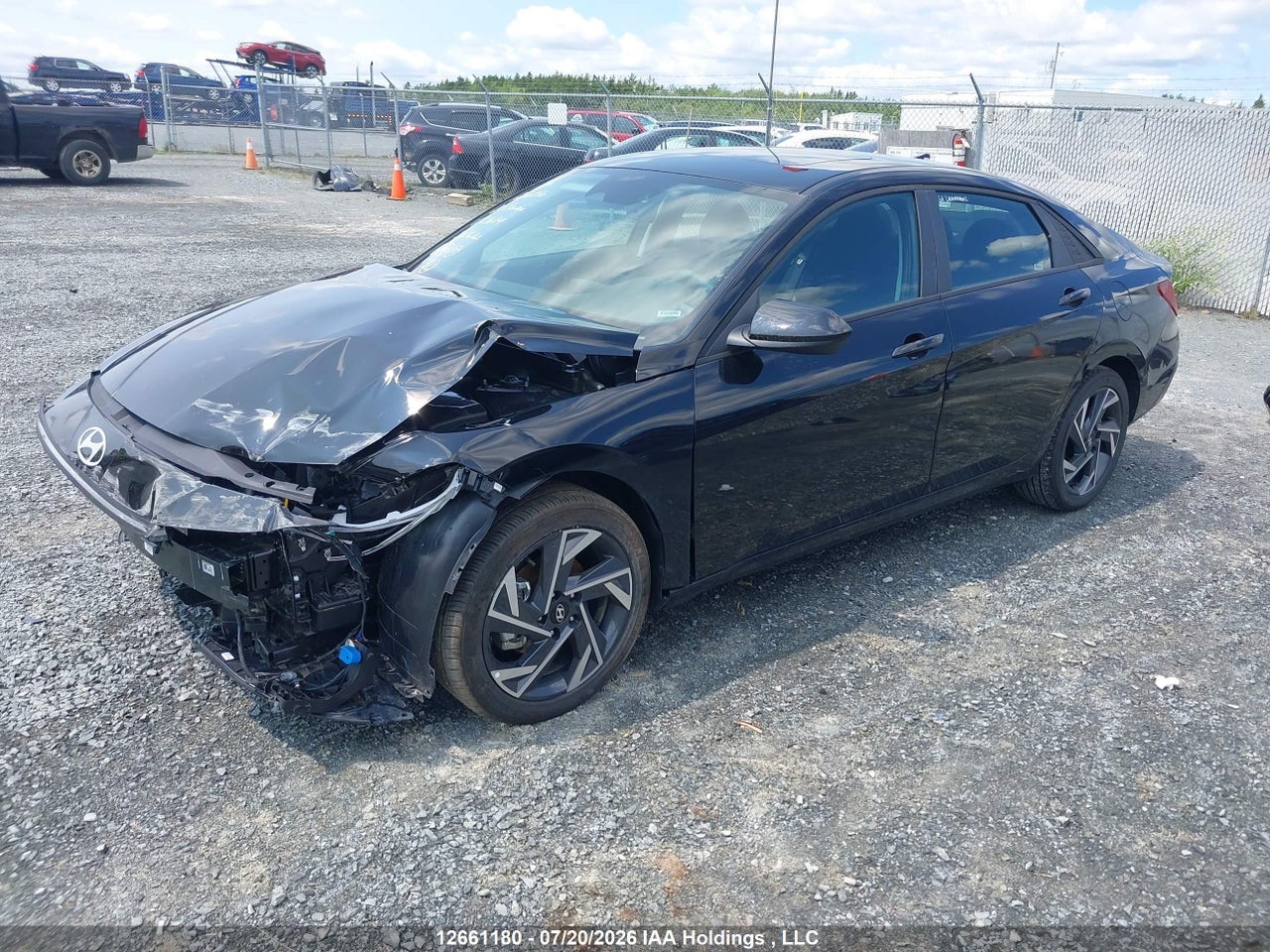 2026 HYUNDAI ELANTRA SEL SPORT thumbnail 3