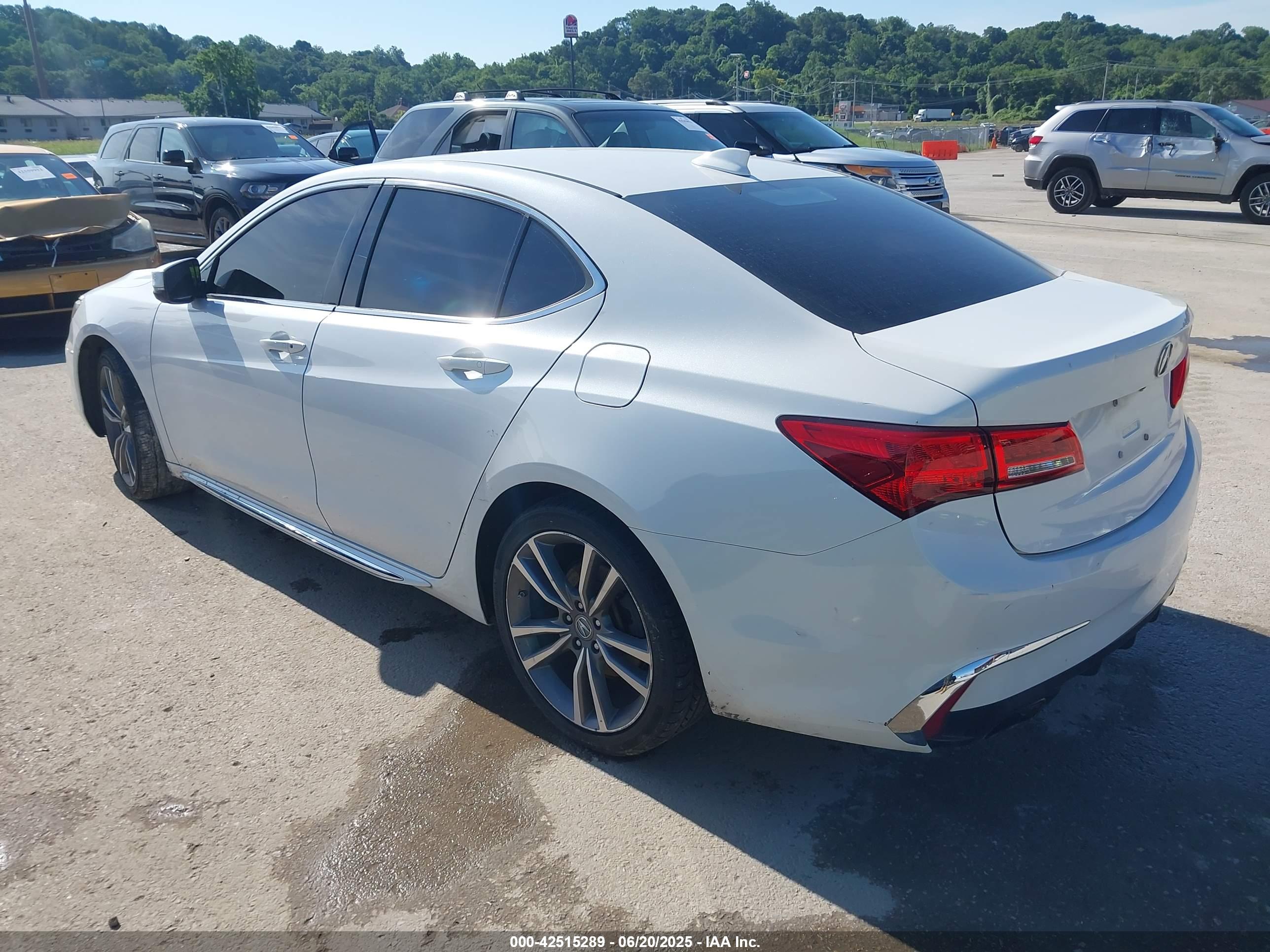 ACURA TLX image 3