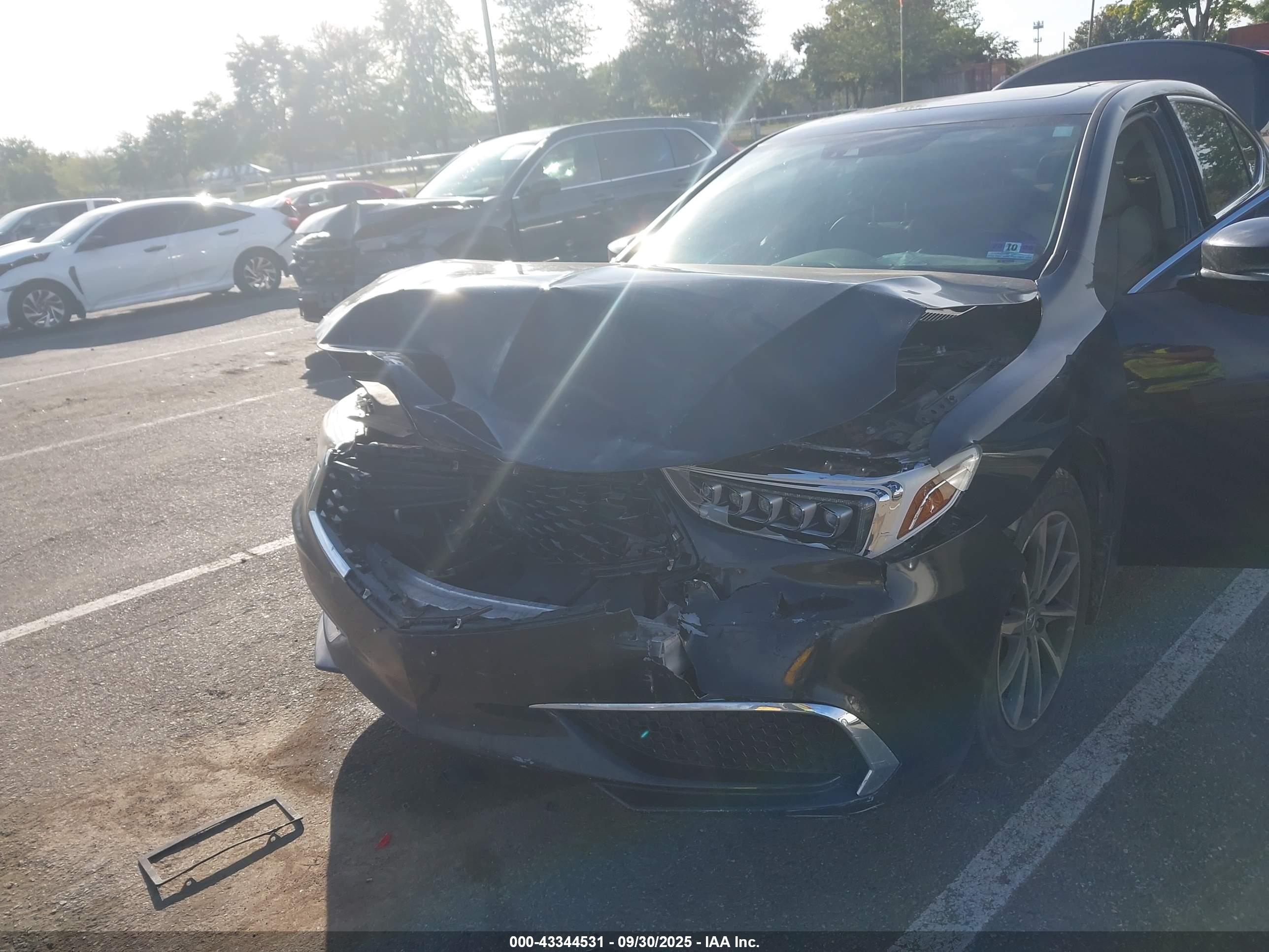 ACURA TLX image 6