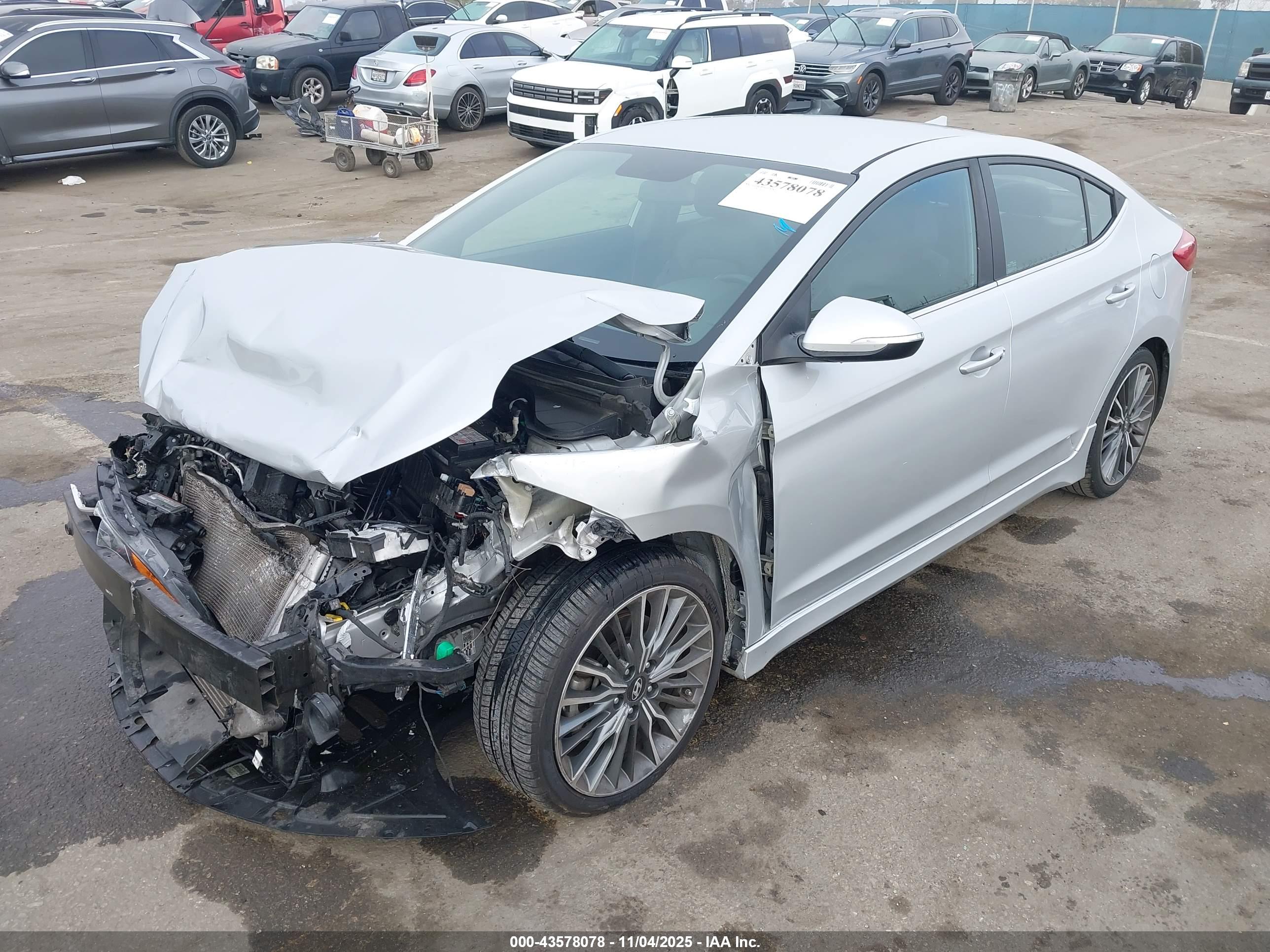 HYUNDAI ELANTRA image 2