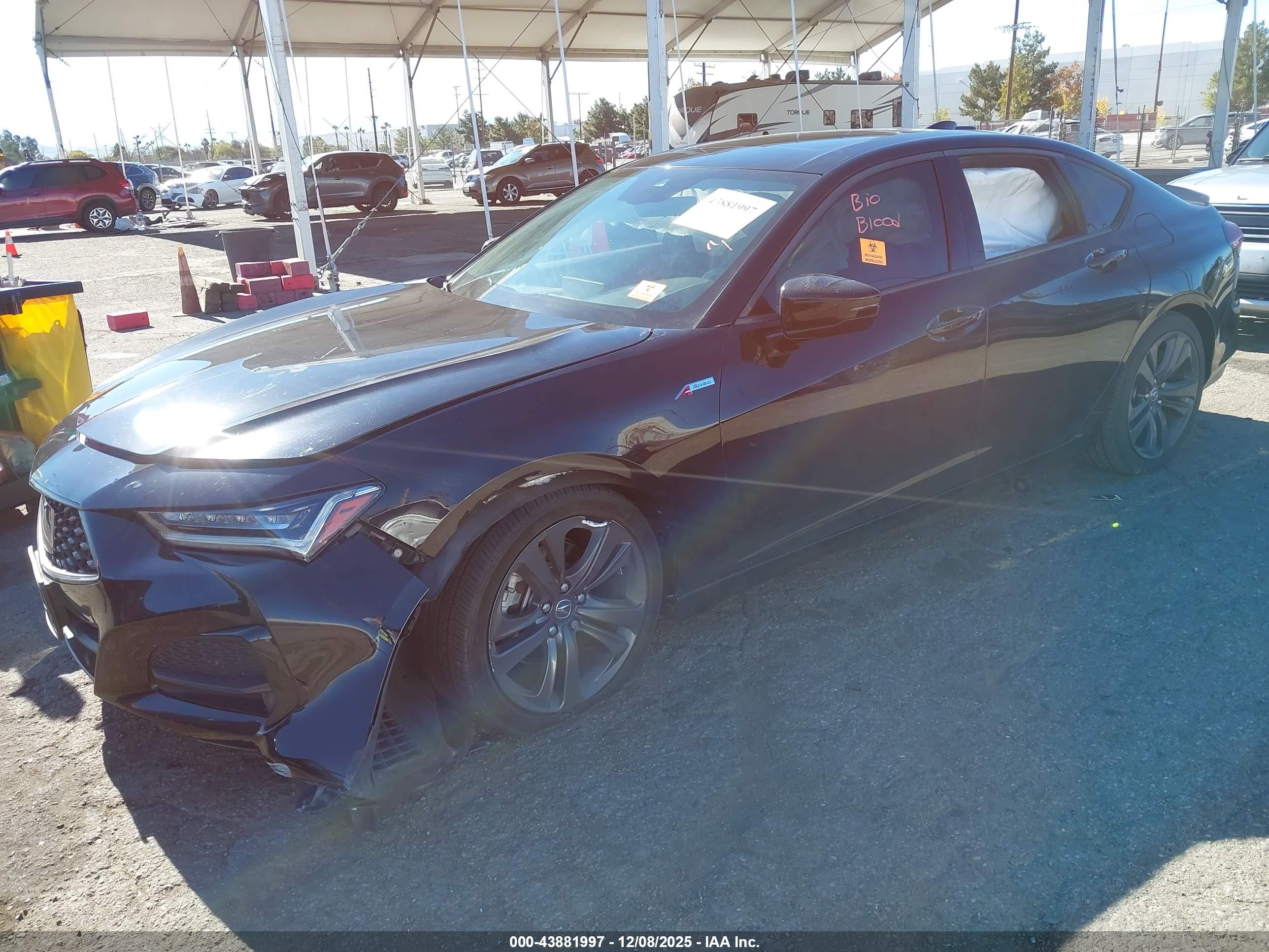 ACURA TLX image 2
