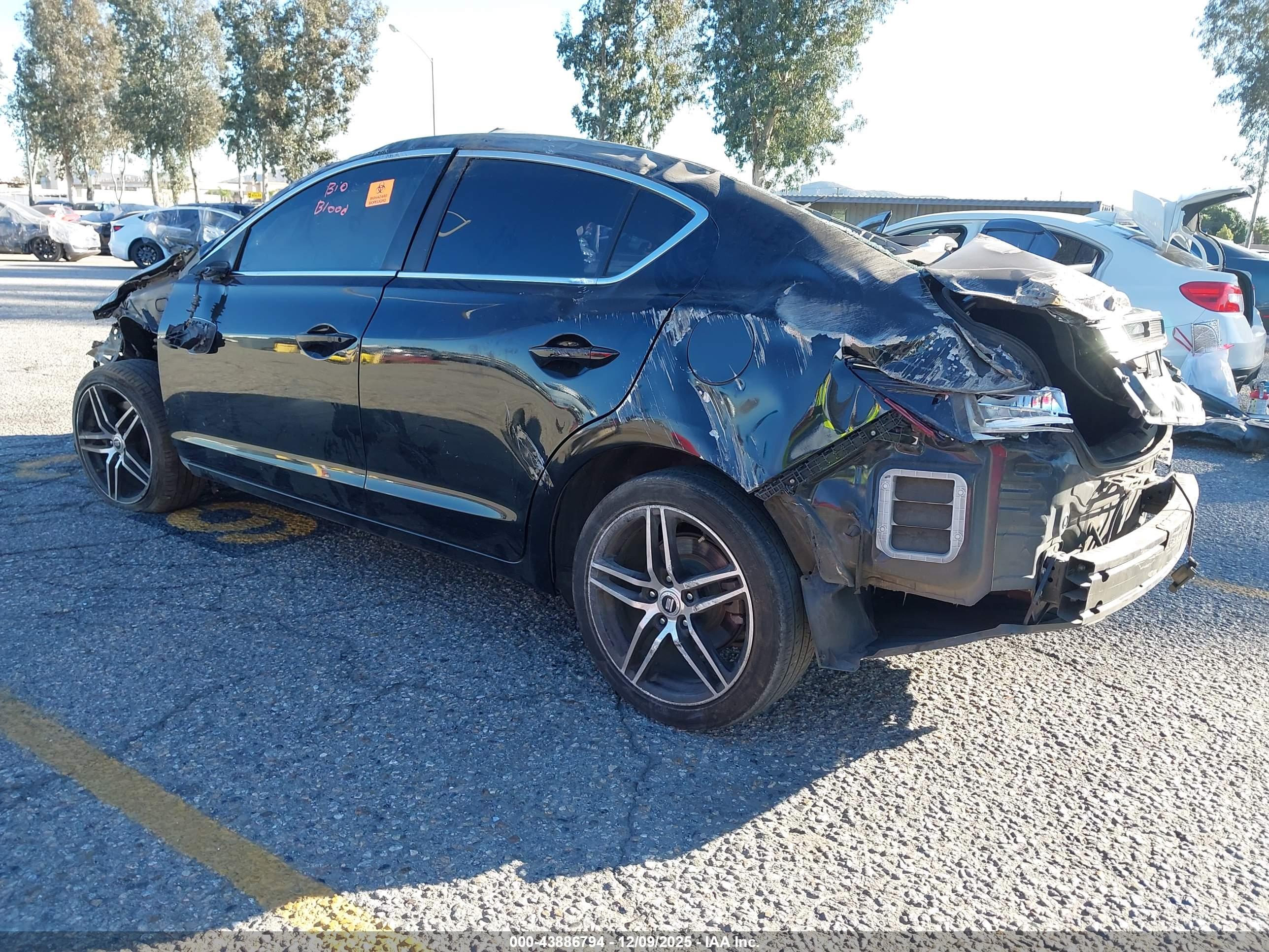 ACURA ILX image 3
