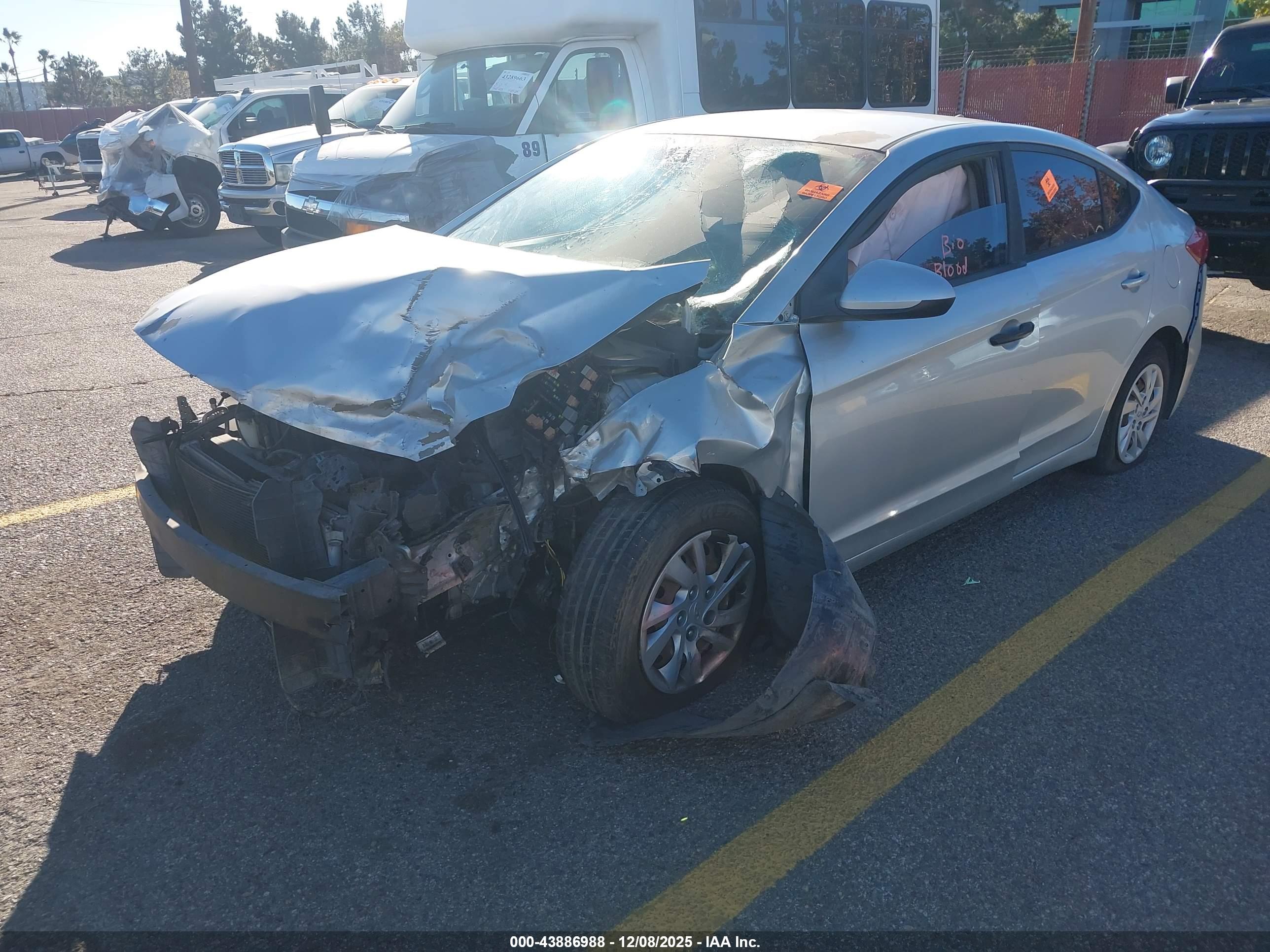 HYUNDAI ELANTRA image 2
