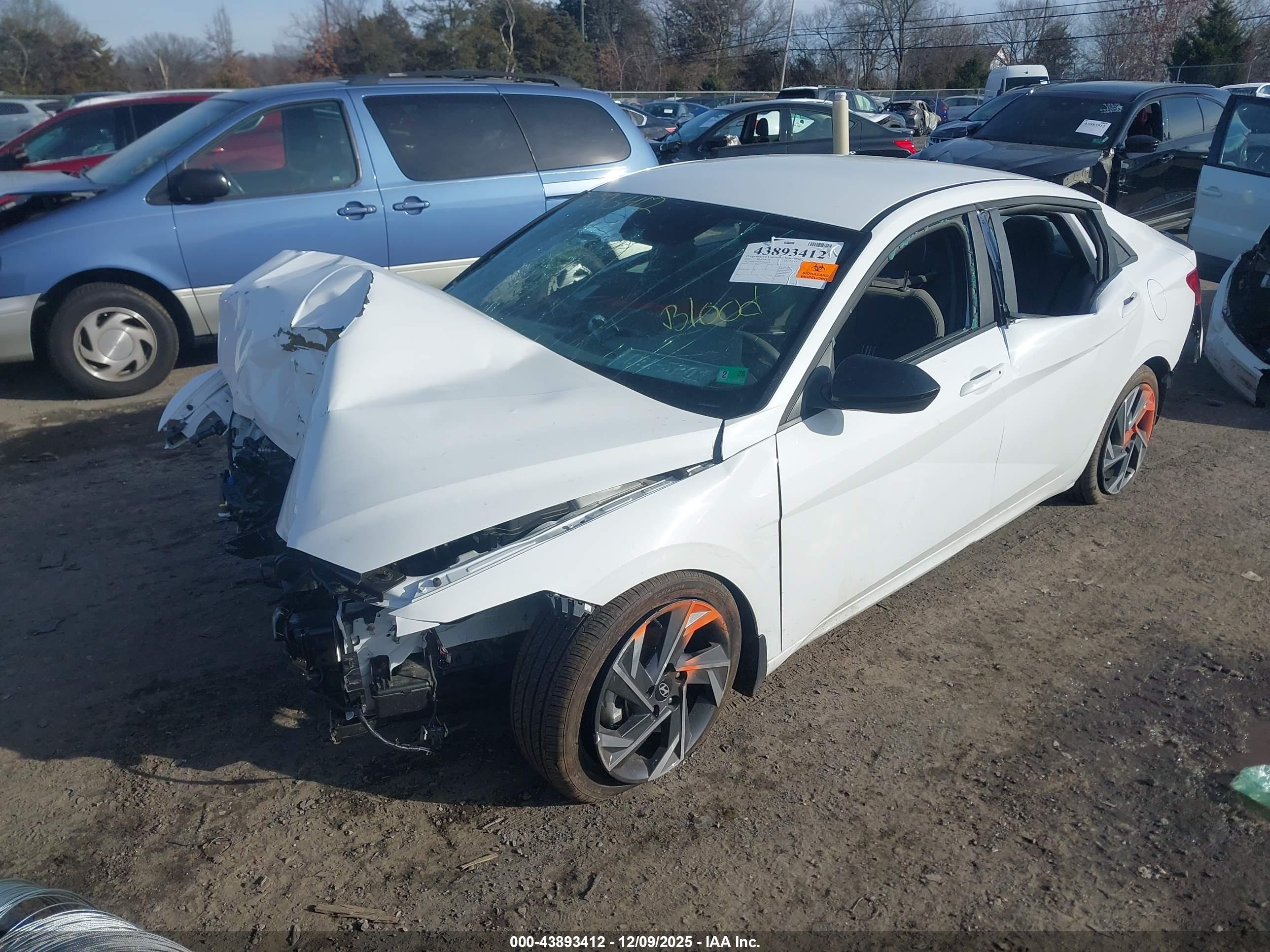 HYUNDAI ELANTRA image 2