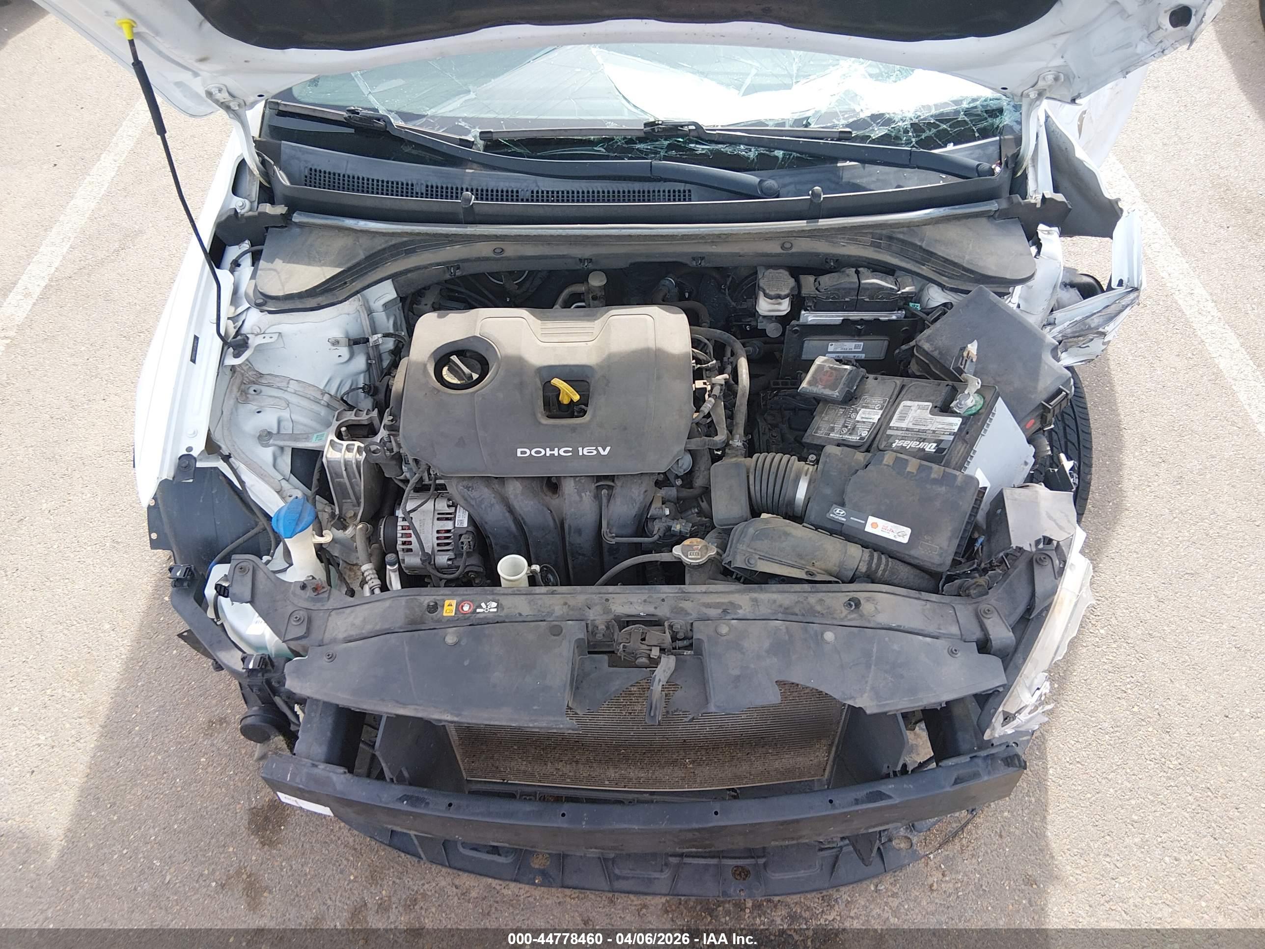 HYUNDAI ELANTRA image 10